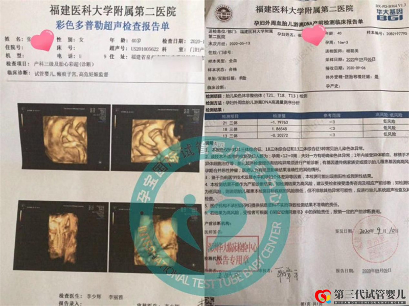 40歲高齡渴求兒女雙全三代試管圓“湊好“之夢(mèng)成功案例(圖1)