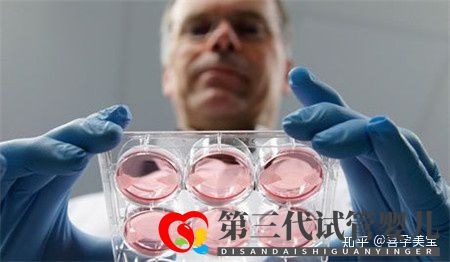 掌控這三點(diǎn),高齡女性做試管嬰兒成功率將達(dá)100%(圖4)
